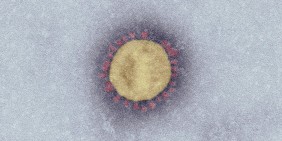SARS-Coronavirus-2 (Elektronenmikroskopie) Bild: Robert Koch-Institut